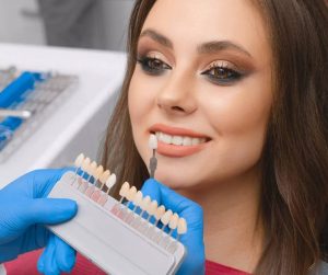 aftercare for teeth whitening Lucan