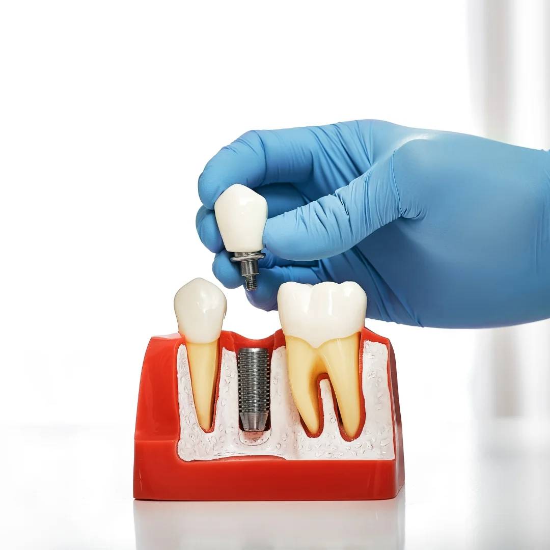 tooth extraction Lucan ON
