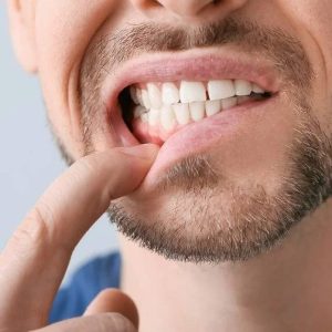 signs of gum disease