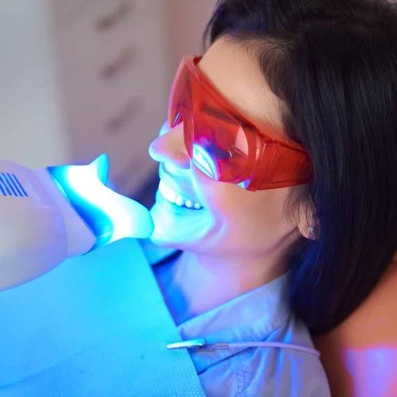 professional teeth whitening in Lucan