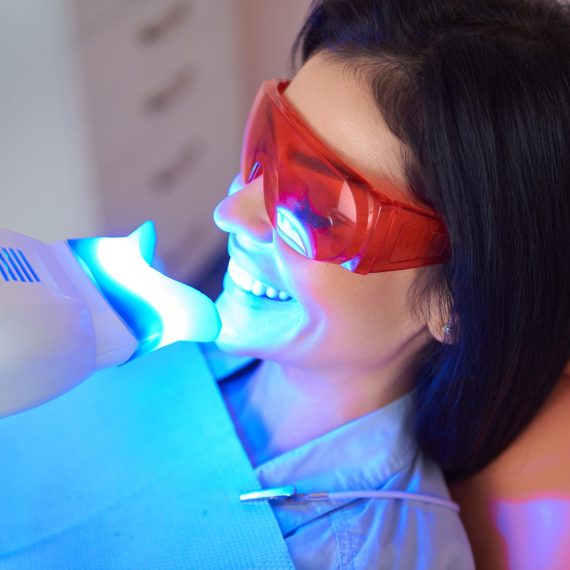 Patient having professional in-office teeth whitening